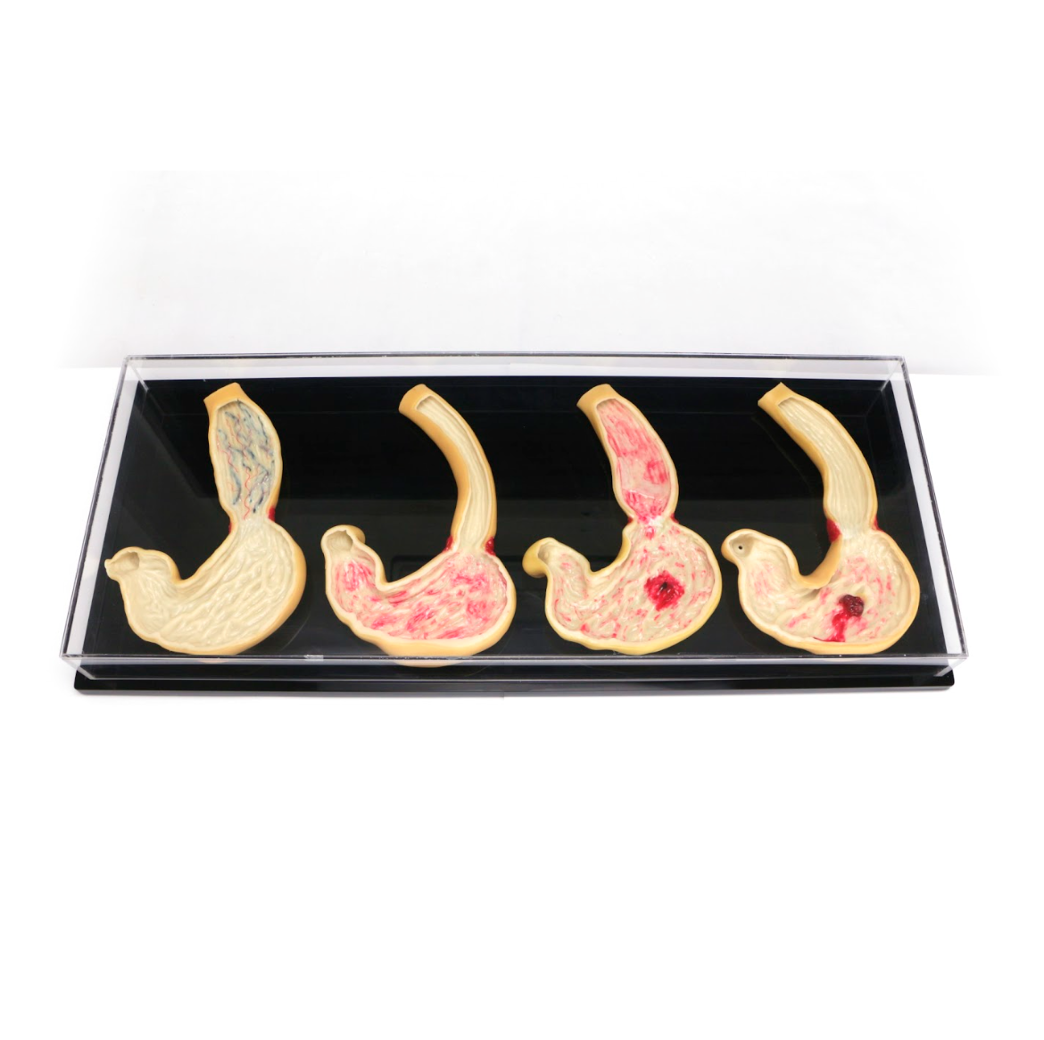 Est Simulator Components Anatomical Simulator for Stomach & Esophagus Pathologies - Pro Delphus